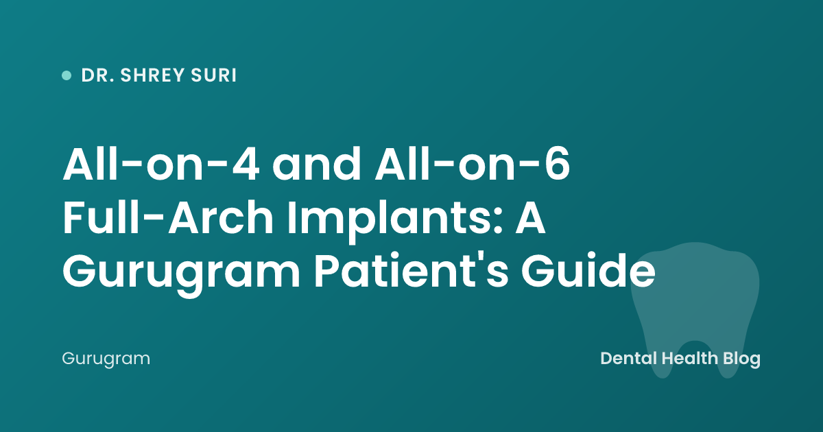 All-on-4 and All-on-6 Full-Arch Implants: A Gurugram Patient's Guide