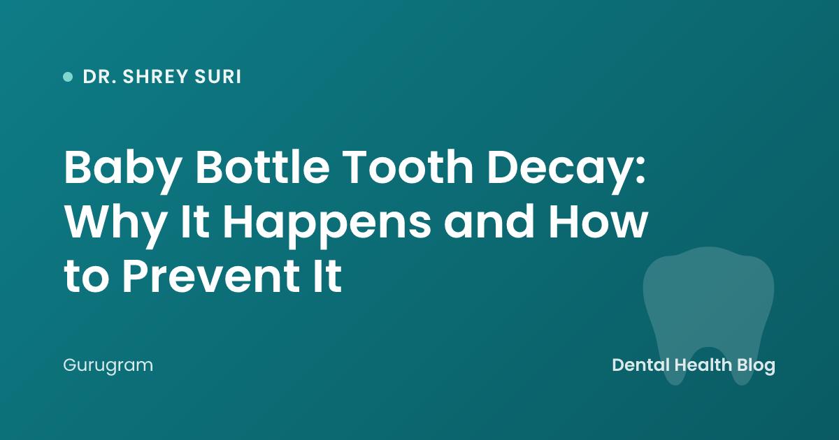 Baby Bottle Tooth Decay: Why It Happens and How to Prevent It