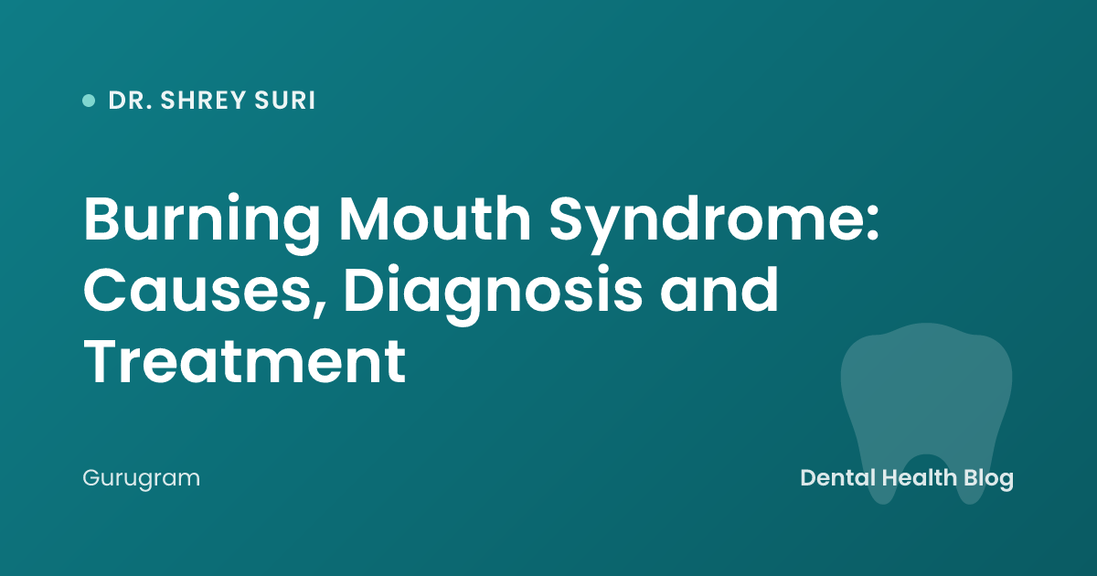 Burning Mouth Syndrome: Causes, Diagnosis and Treatment