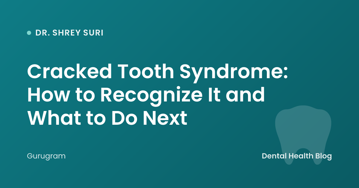 Cracked Tooth Syndrome: How to Recognize It and What to Do Next