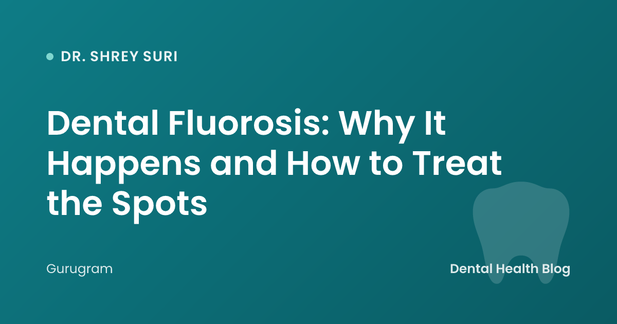 Dental Fluorosis: Why It Happens and How to Treat the Spots