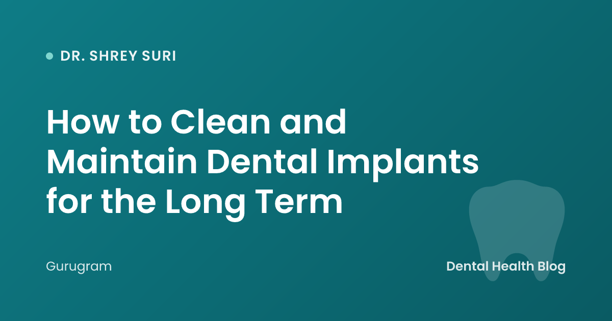 How to Clean and Maintain Dental Implants for the Long Term