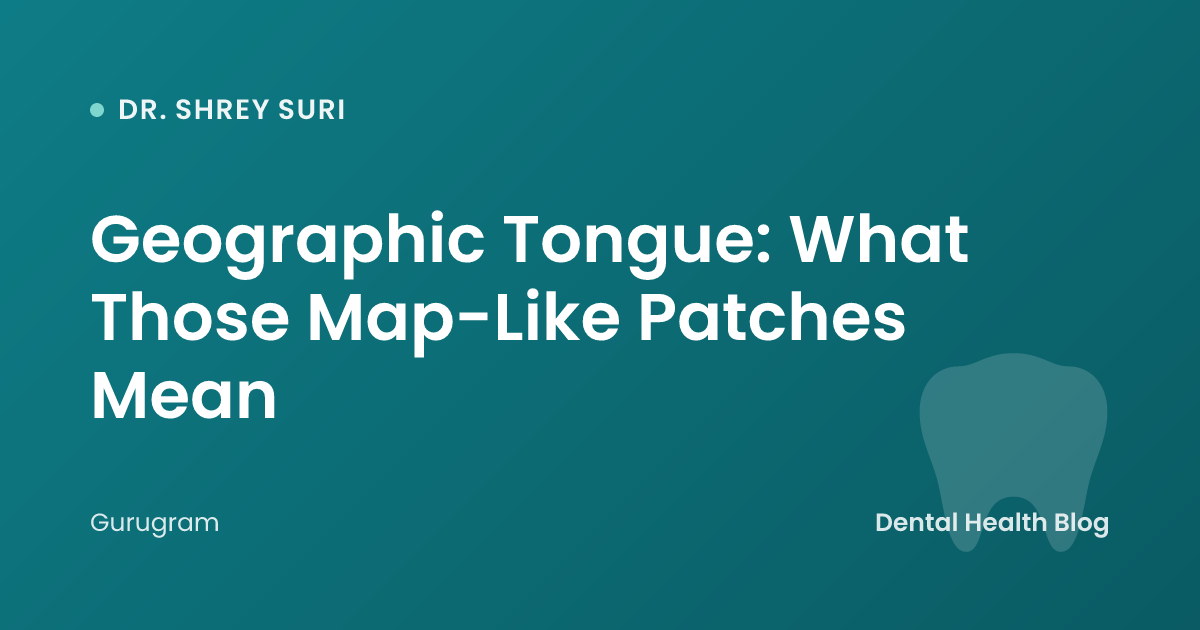 Geographic Tongue: What Those Map-Like Patches Mean