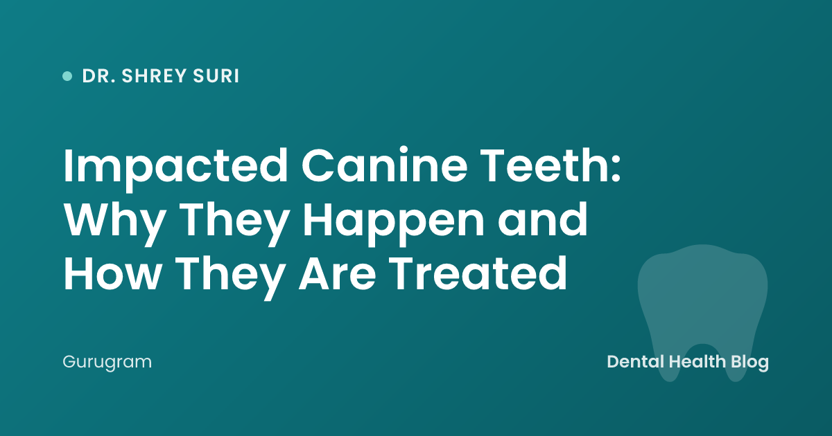 Impacted Canine Teeth: Why They Happen and How They Are Treated