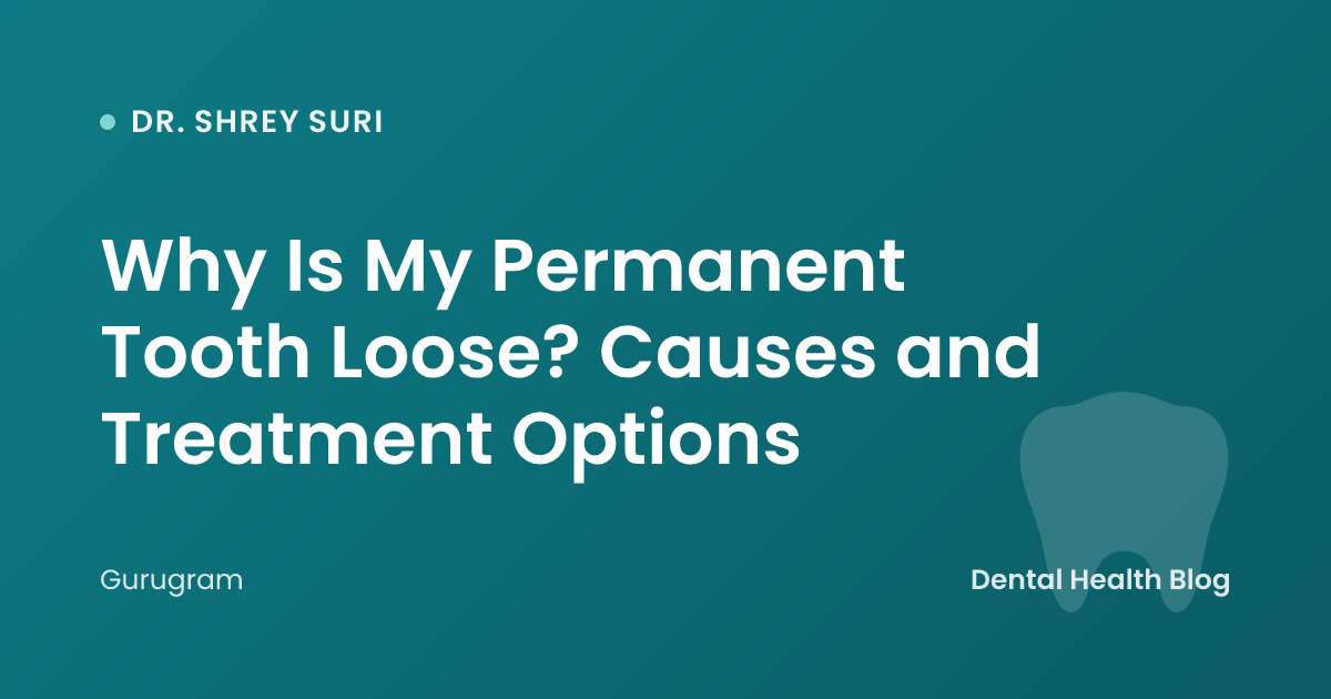 Why Is My Permanent Tooth Loose? Causes and Treatment Options