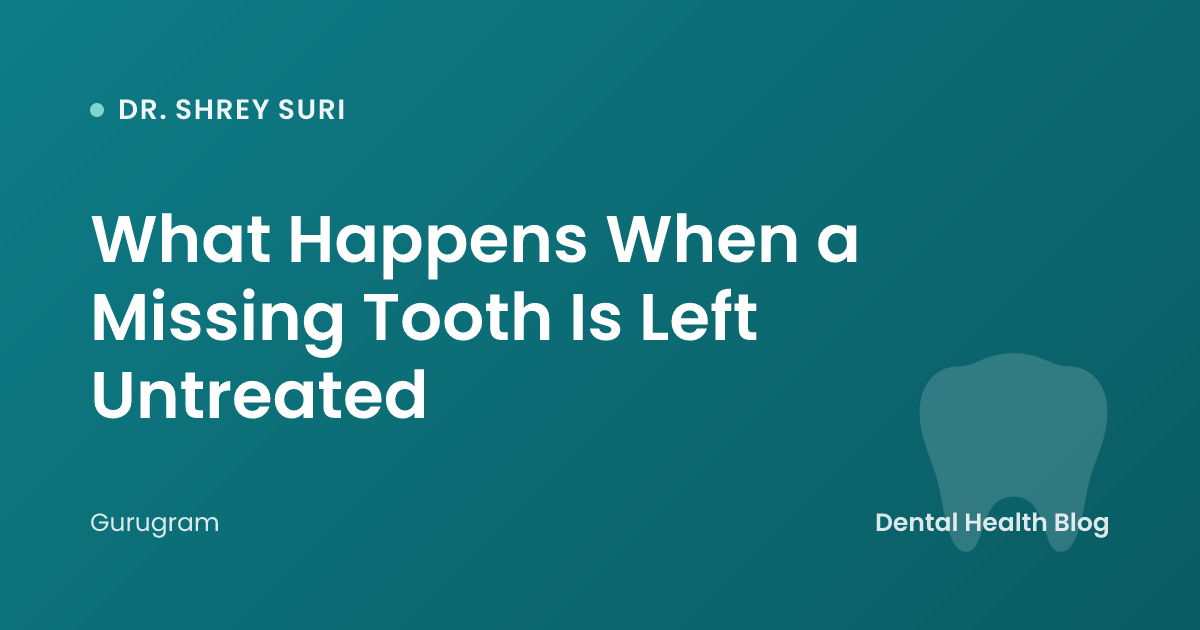 What Happens When a Missing Tooth Is Left Untreated