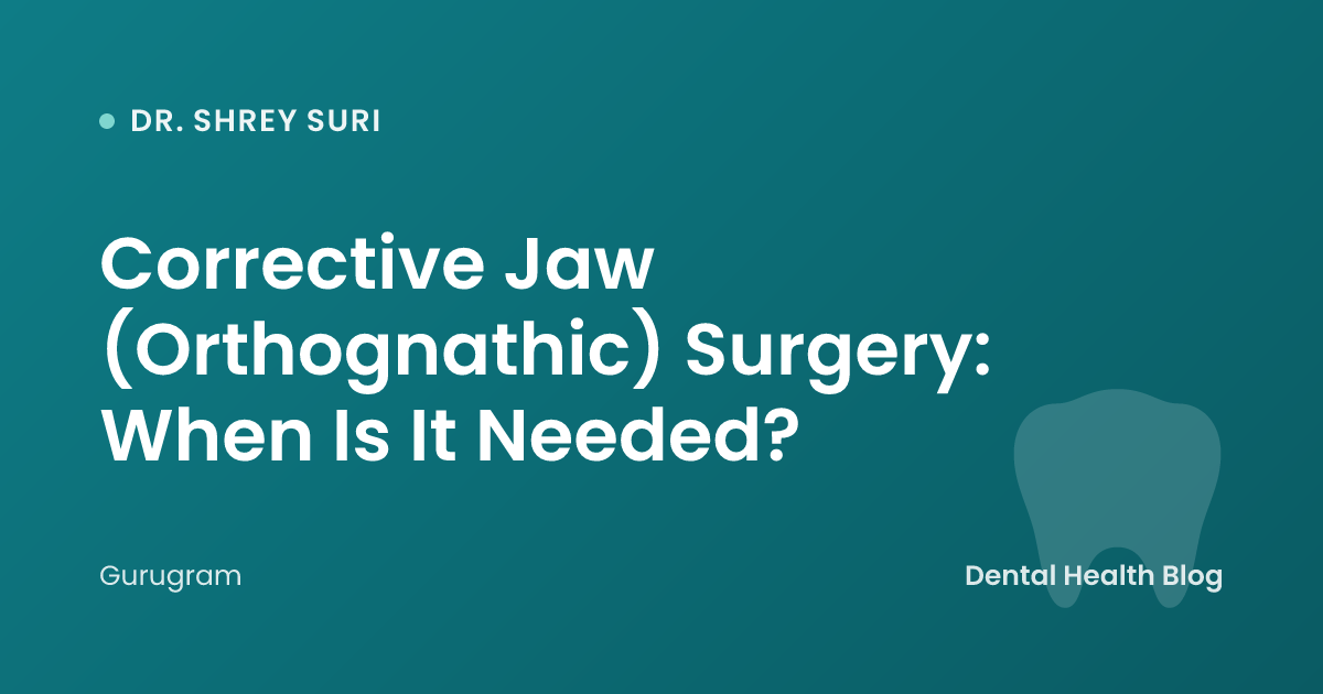 Corrective Jaw (Orthognathic) Surgery: When Is It Needed?