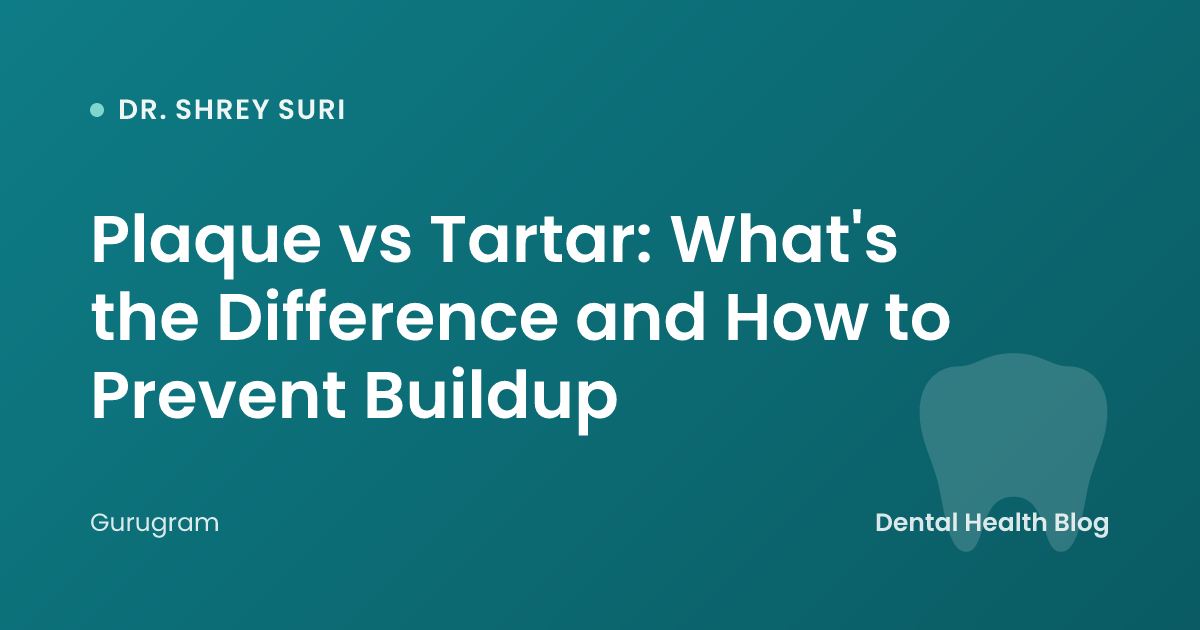 Plaque vs Tartar: What's the Difference and How to Prevent Buildup