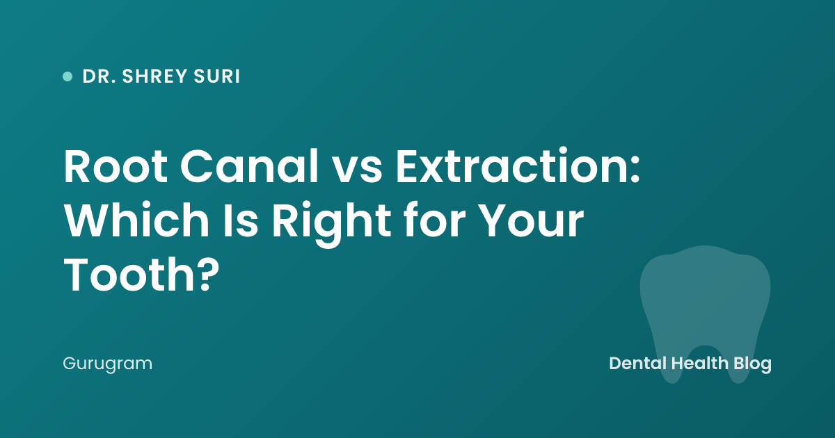 Root Canal vs Extraction: Which Is Right for Your Tooth?
