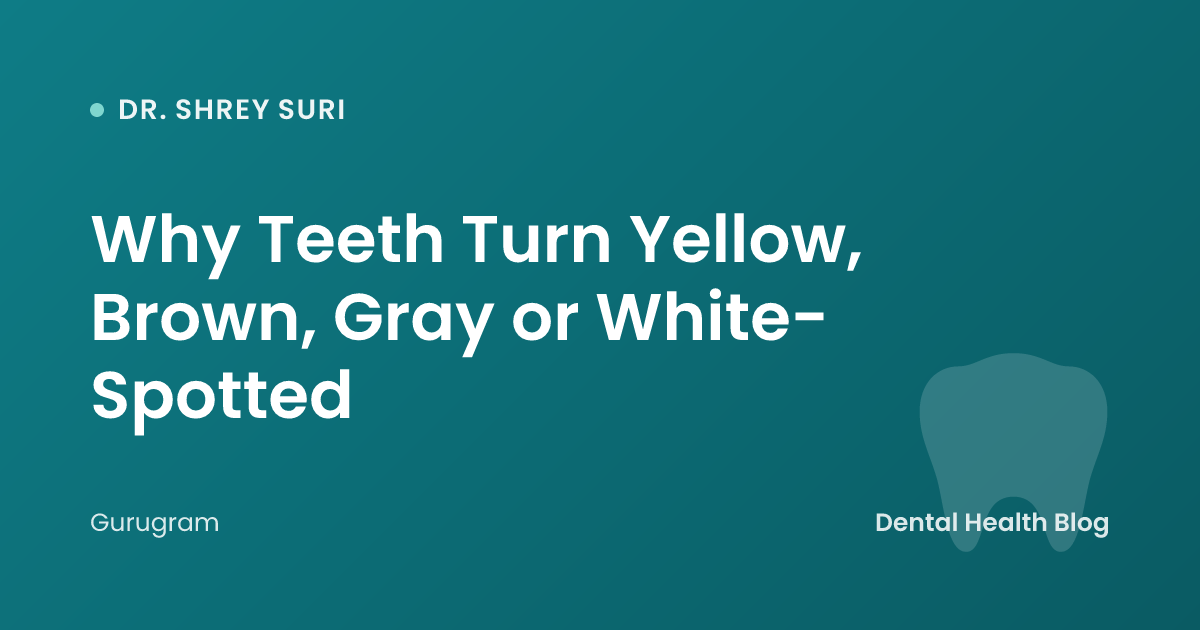 Why Teeth Turn Yellow, Brown, Gray or White-Spotted
